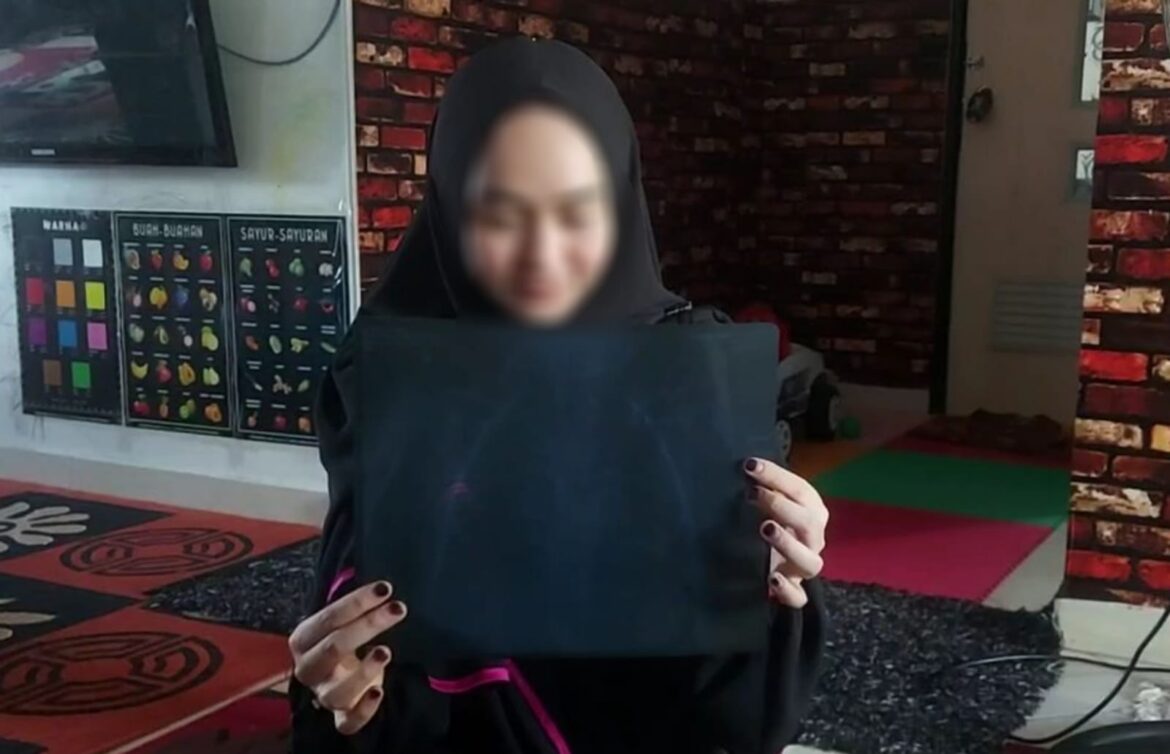Orang tua korban menunjukan hasil rontgen kepada wartawan. (Foto: Iman Satria)