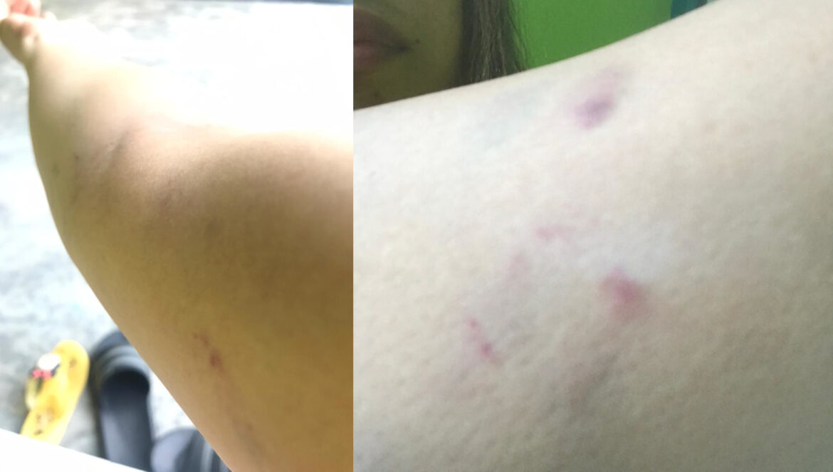 AYAH JFG memperlihatkan bukti penganiayaan yang diduga dilakukan Feedy terhadap istrinya Hl (Foto Istimewa)