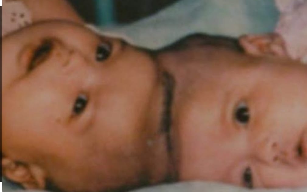 KEMBAR siam Yuliana dan Yuliani bersama dokter Padmosantjojo dan istri yang telah berjasa untuk mereka. Kini mereka telah menjadi seorang doktor dan dokter (foto istimewa)