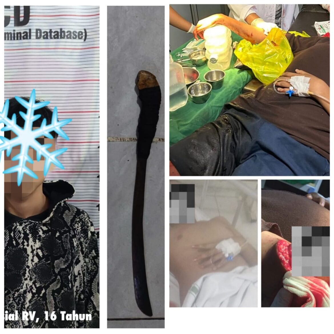 KORBAN ANIAYA - Geng motor yang diduga sempat tawuran hingga seorang korban mengalami luka serius akibat diserang pelaku yang kini sudah dtangkap, Minggu (23/6/2024) dinihari. (foto:ist)