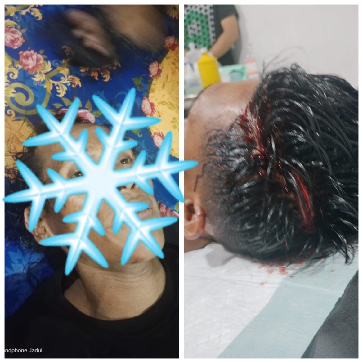 Pelaku (kiri) Aniaya tetangga berinisial AB ini juga mengalami luka karena terjadi dan dipukul korbannya bernama Syarifudin (kanan), Minggu (1/12/2024) sore. (Ist)